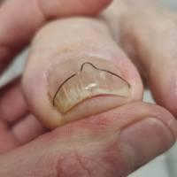 Fótaaðgerðastofan Furugerði 1